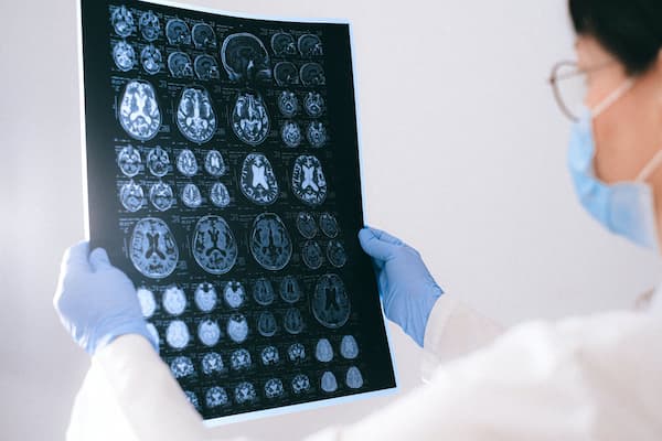 X-ray of a brain neuromarketing