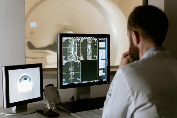 doctor evaluating MRI photos