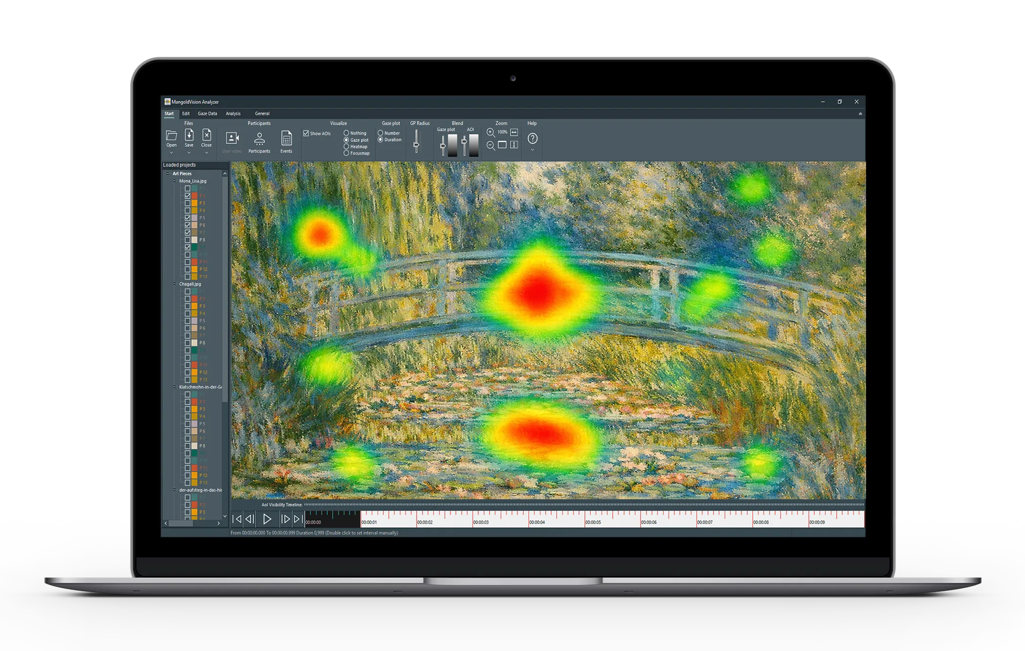 Mangold Vision Eye Tracking Software